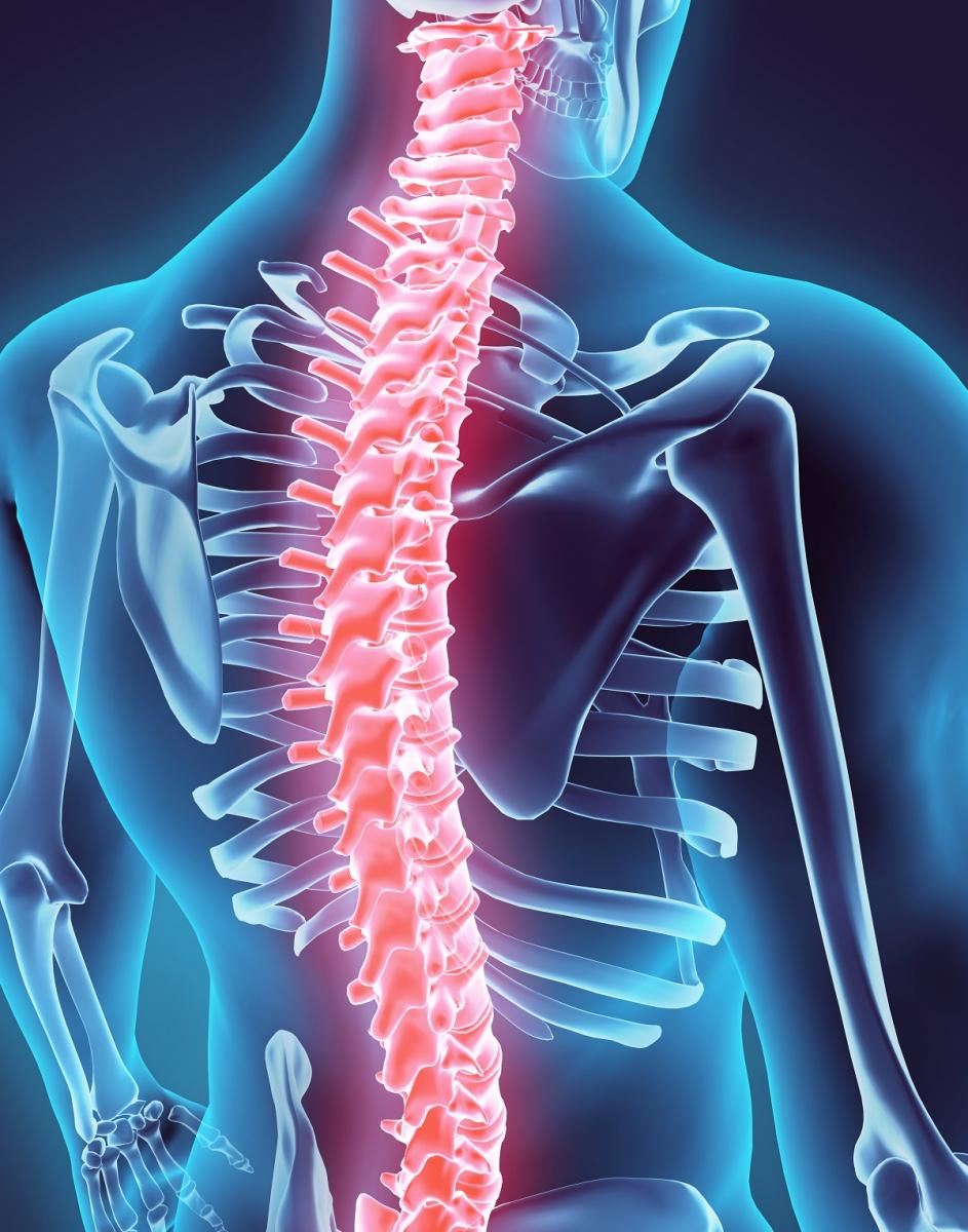 severed-spinal-cord-claims-how-much-compensation-can-you-claim